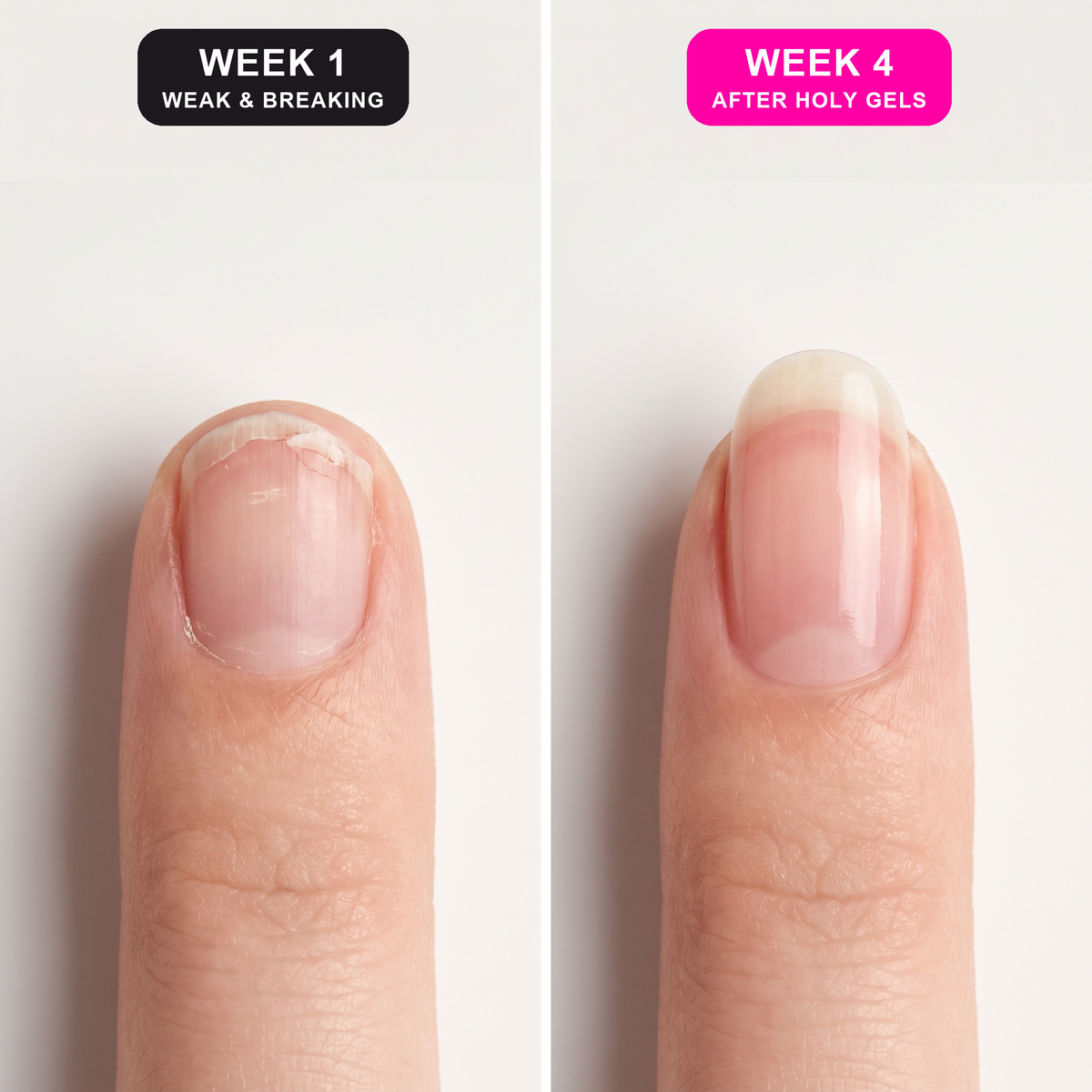 🌱 I Could Finally Let My Nails Grow Out Without Hating How They Looked